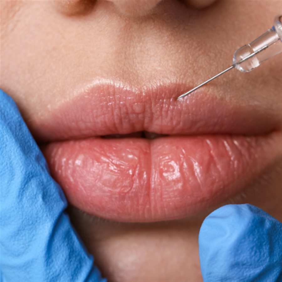 Lip Correction in Jalandhar consultation at Beyond Aesthetix Jalandhar